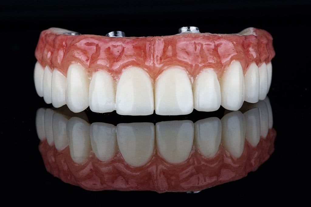 Prótesis dentales en Antequera